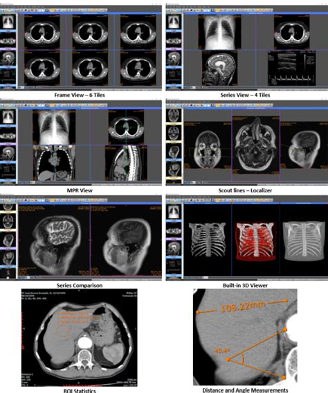 Sante DICOM Editor 3D